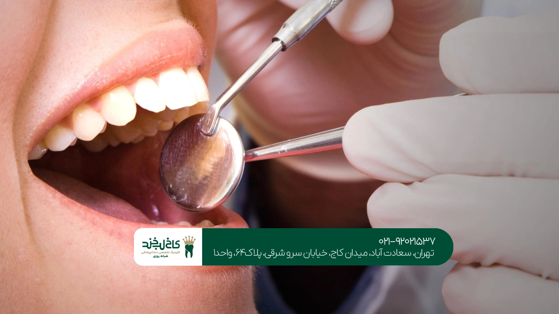 هزینه دندانپزشکی اقساطی سعادت آباد