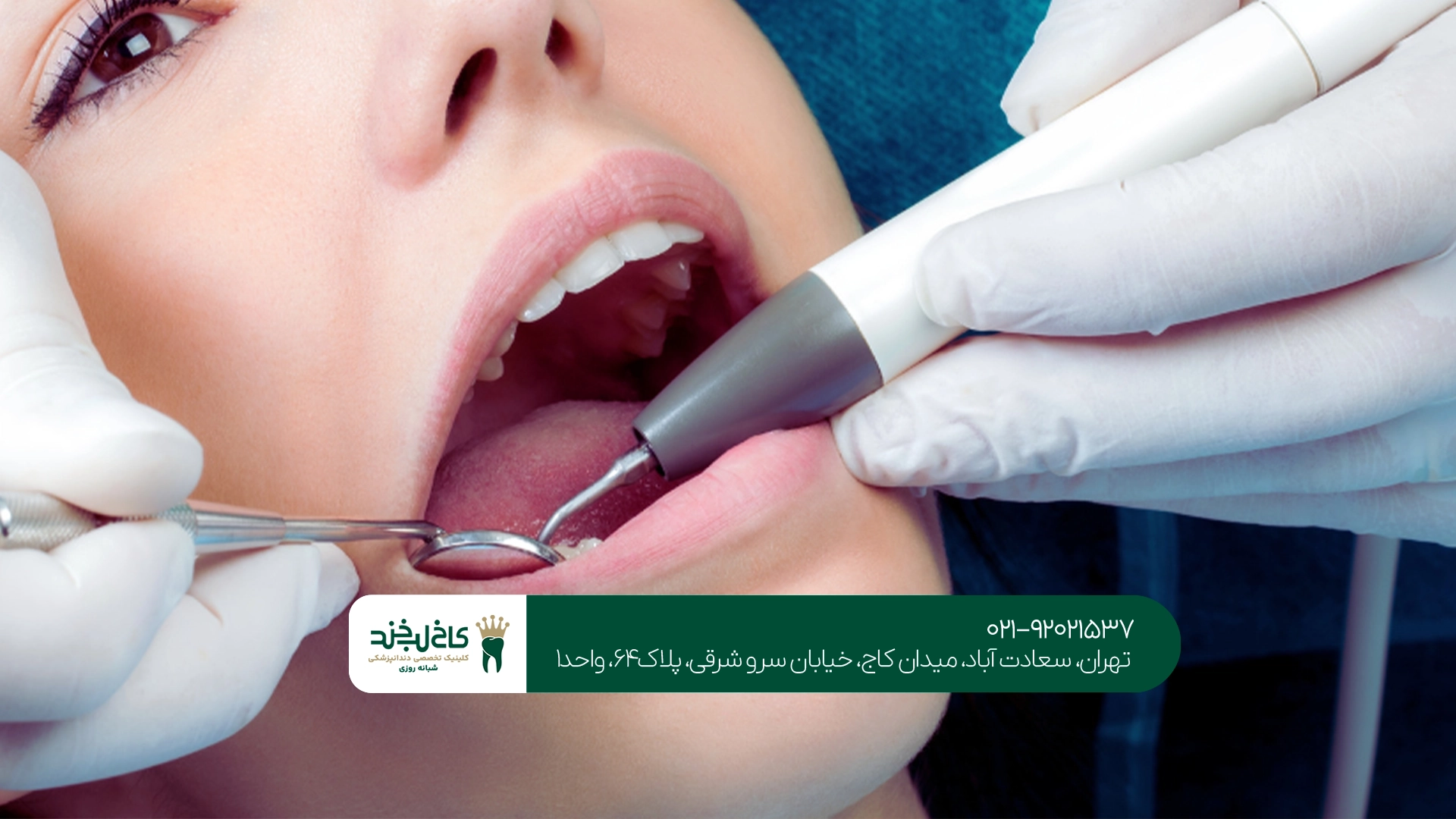 دندانپزشکی اقساطی تهران دندانپزشکی اقساطی تهران