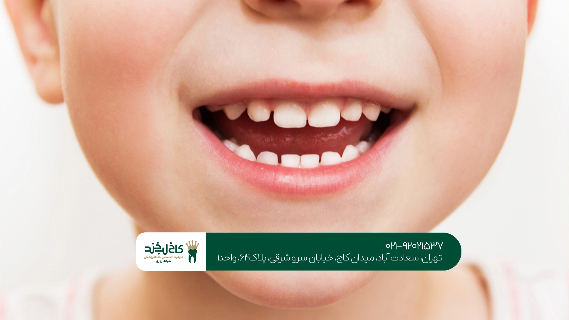 دندانپزشکی کودکان دندانپزشکی کودکان