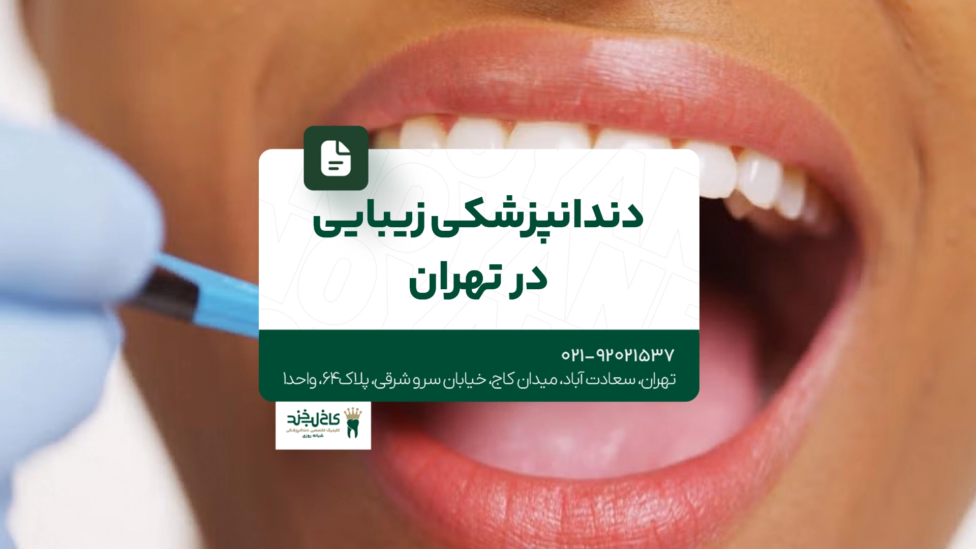 دندانپزشکی زیبایی در تهران