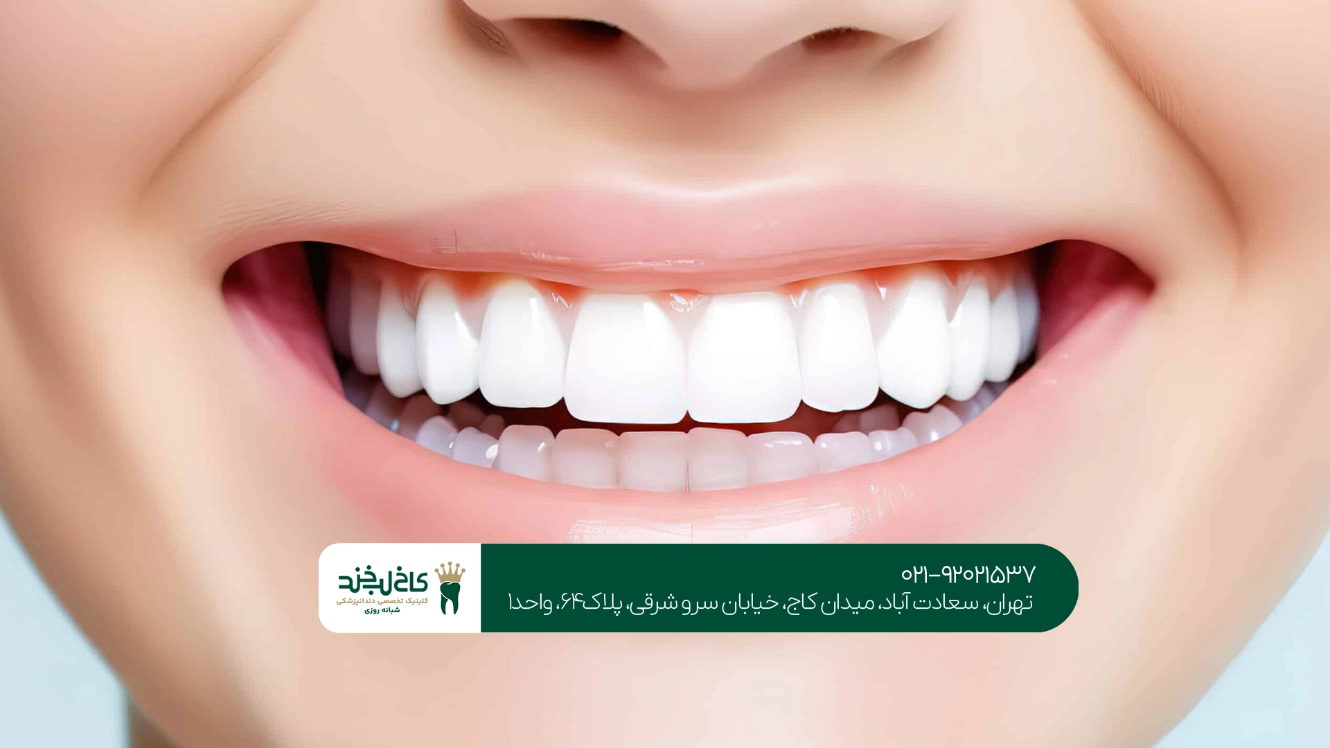 متخصص دندانپزشکی زیبایی در تهران