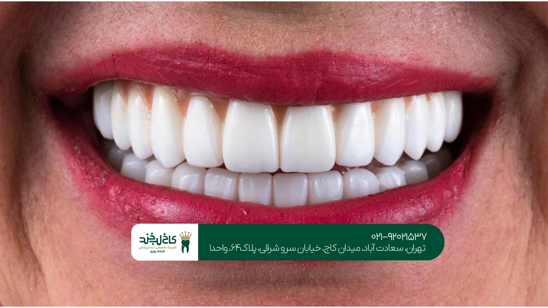دندانپزشکی زیبایی برای چه افرادی مناسب است؟