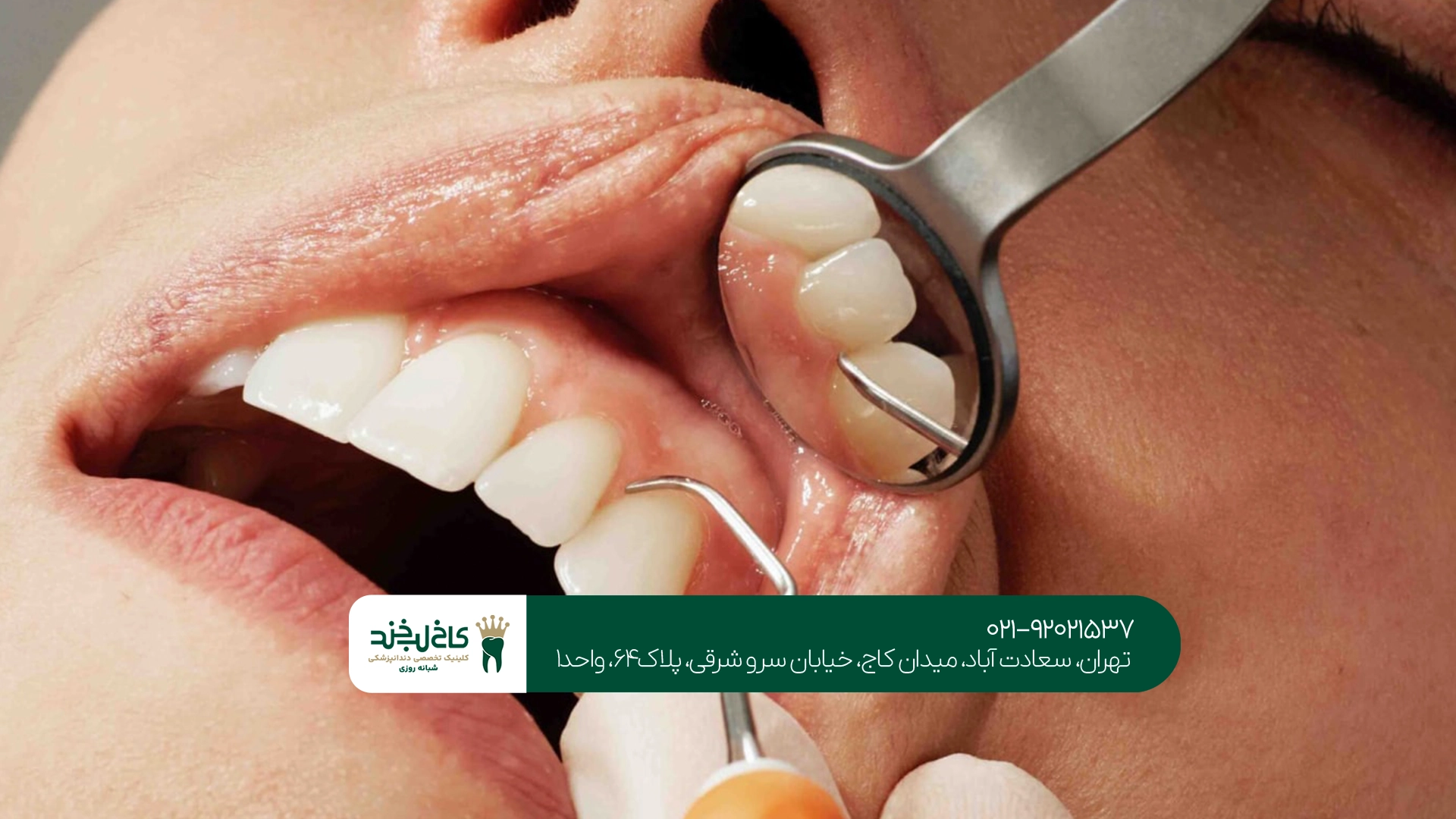 دندانپزشکی تهران دندانپزشکی تهران