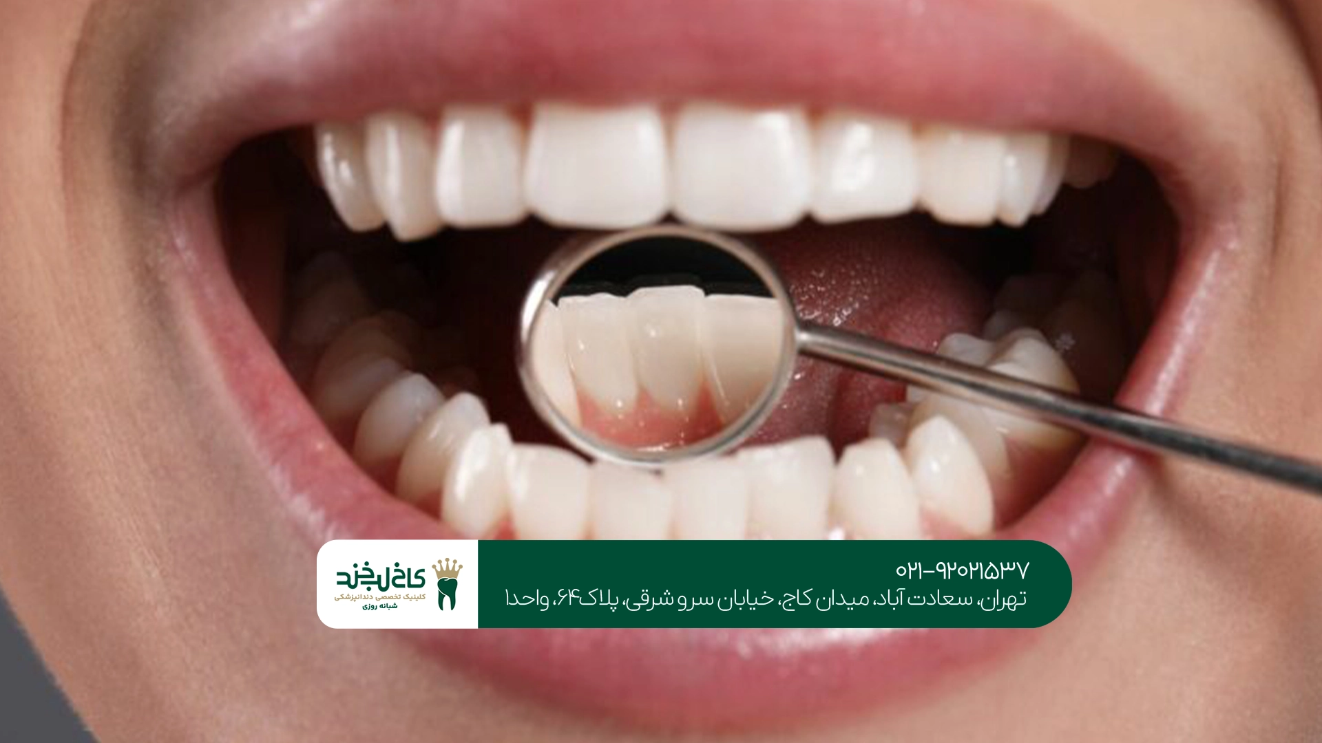 چه زمانی باید به دندانپزشک عمومی مراجعه کنیم؟