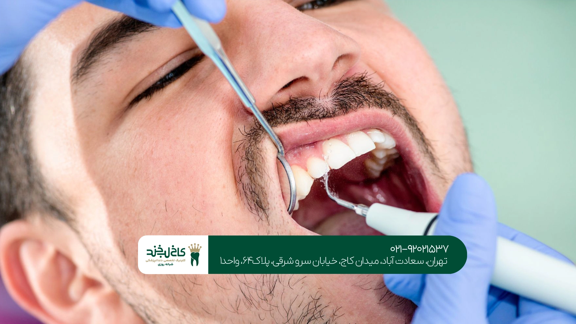 مزایای انجام درمان در کلینیک دندانپزشکی تخصصی و عمومی