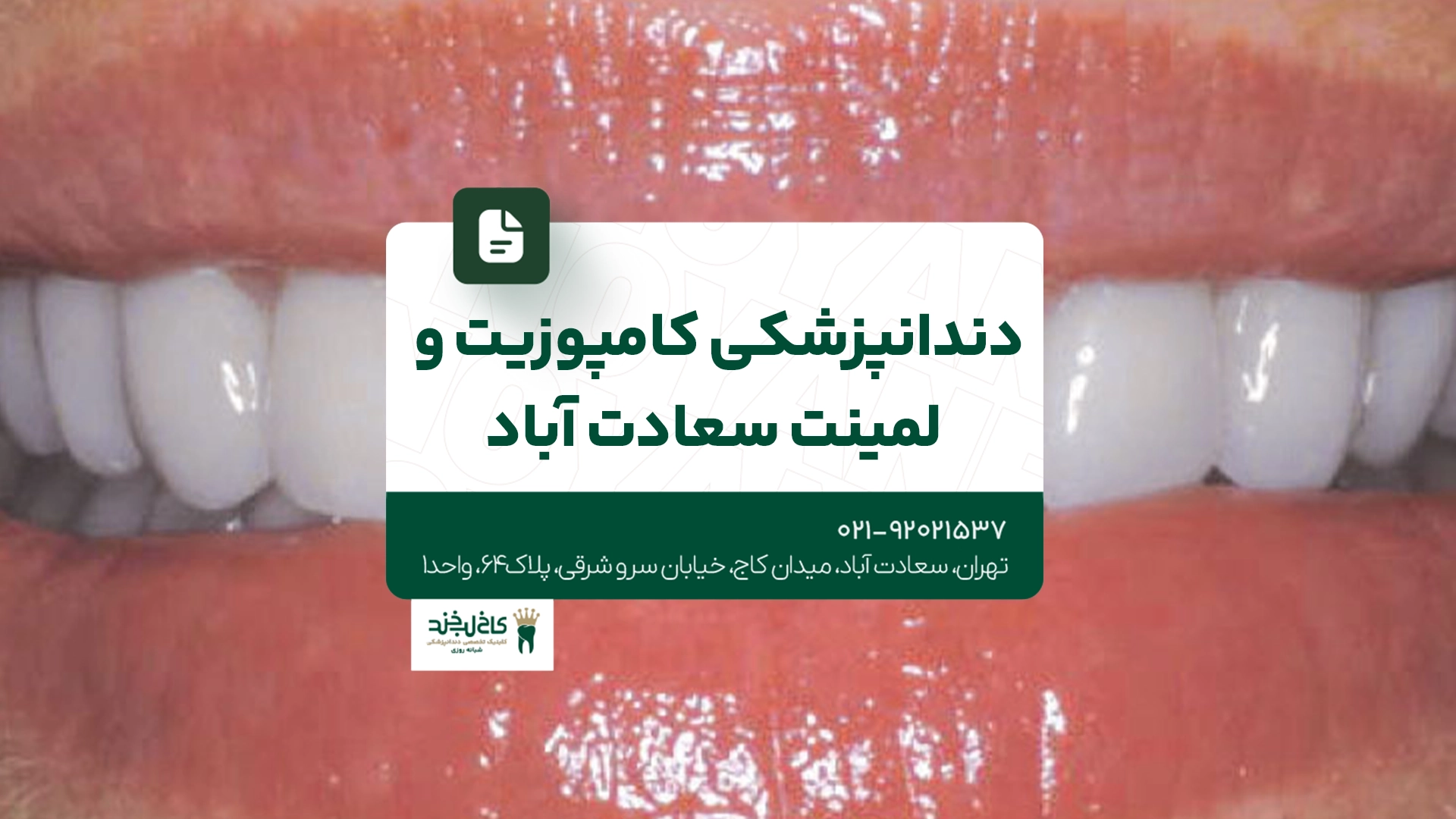 دندانپزشکی کامپوزیت و لمینت سعادت آباد