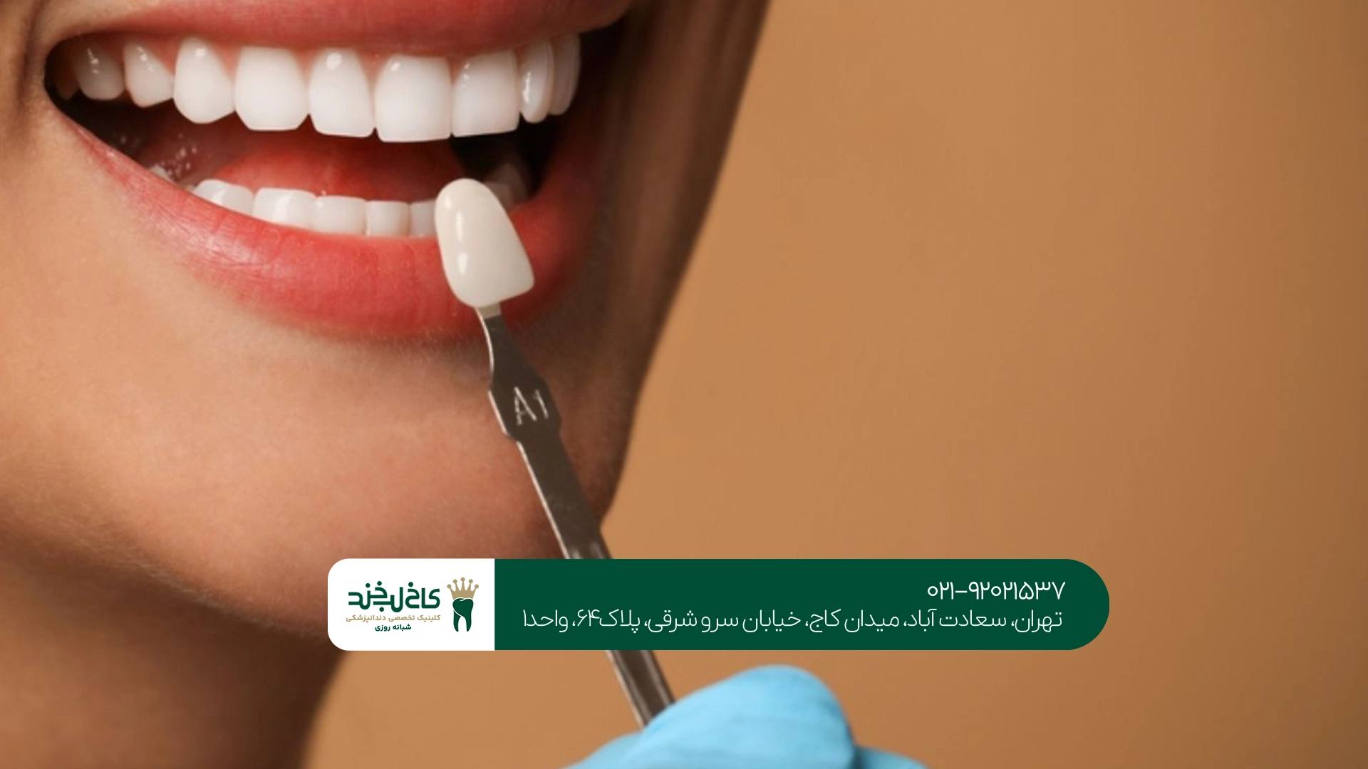 بهترین روکش دندان سرامیکی
