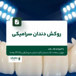 روکش دندان سرامیکی