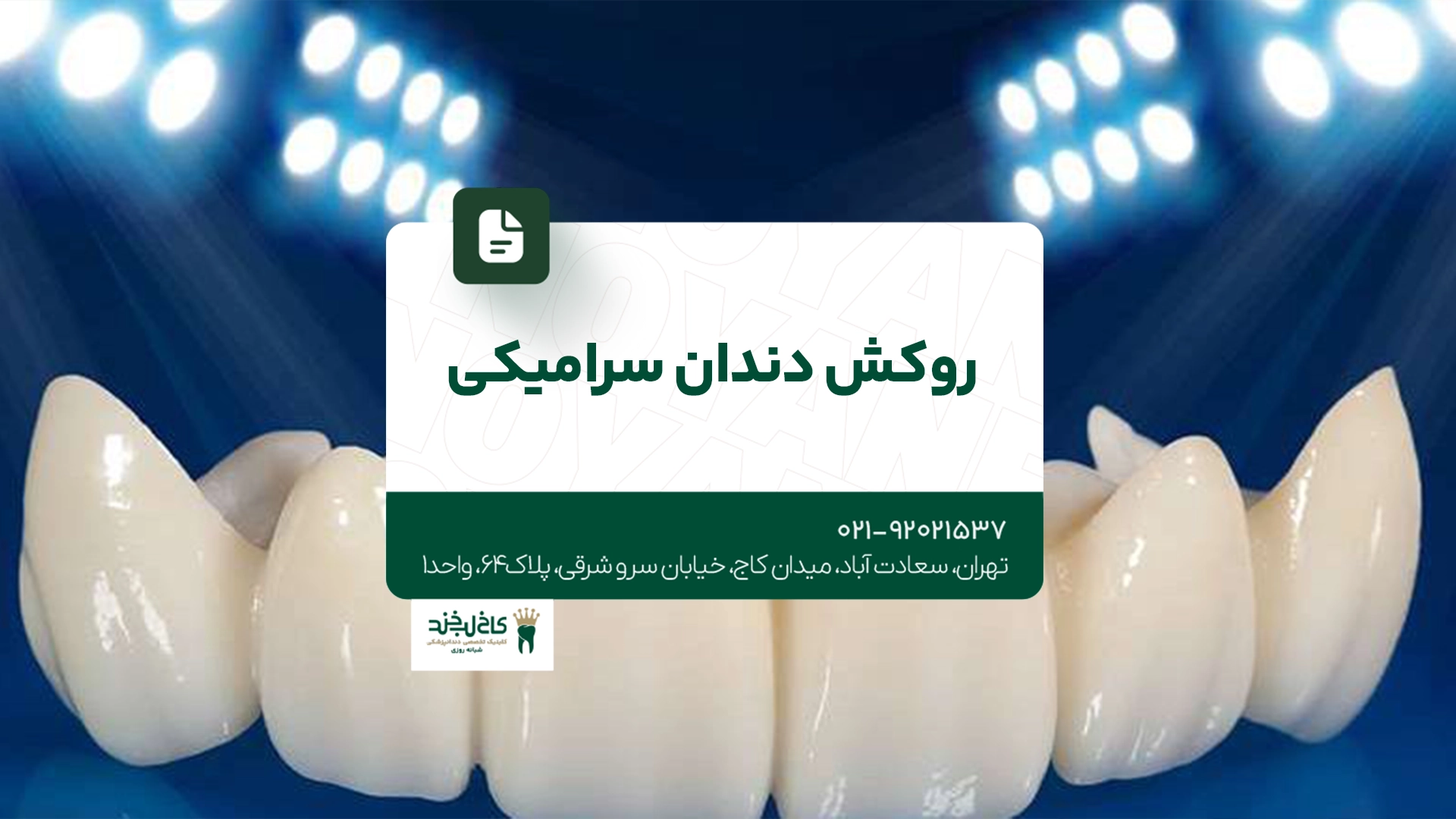 روکش دندان سرامیکی