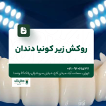 روکش زیرکونیا دندان