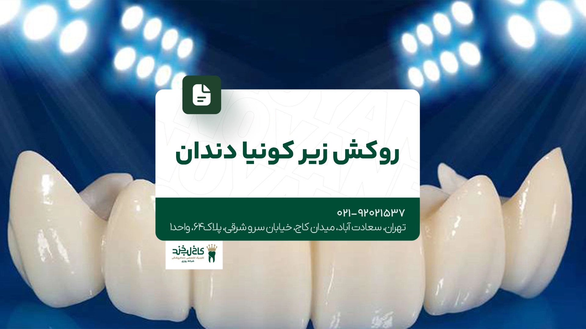 روکش زیرکونیا دندان روکش زیرکونیا دندان