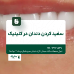 سفید کردن دندان در کلینیک