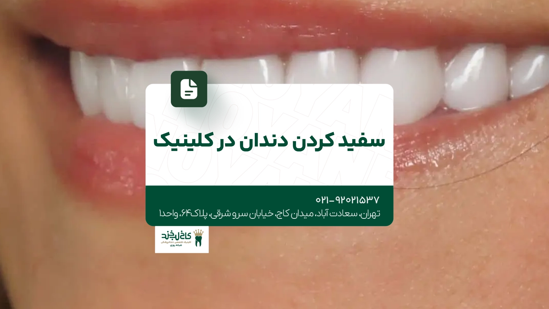 سفید کردن دندان در کلینیک