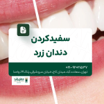 سفید کردن دندان زرد