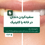 سفید کردن دندان در خانه یا کلینیک
