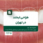 طراحی لبخند در تهران