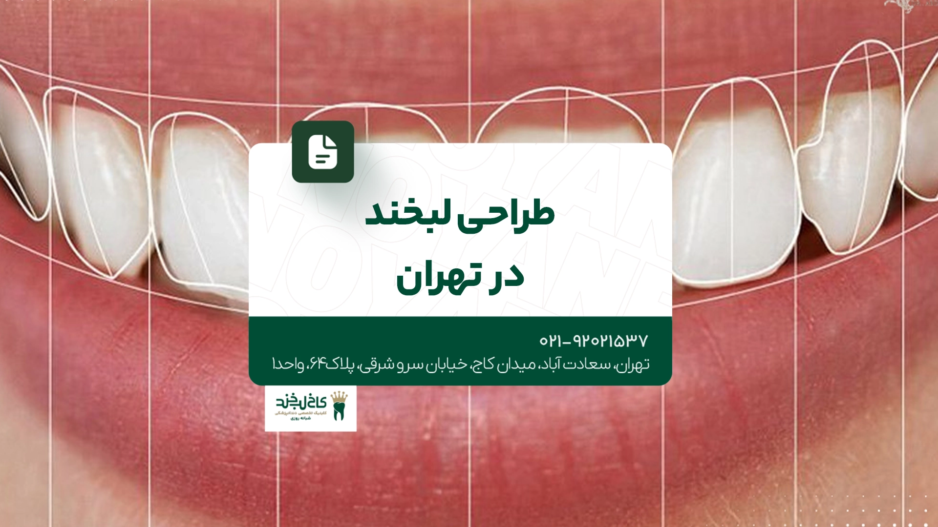 طراحی لبخند در تهران