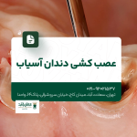 عصب کشی دندان آسیاب