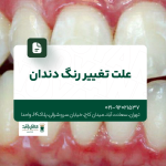 علت تغییر رنگ دندان