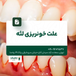 علت خونریزی لثه