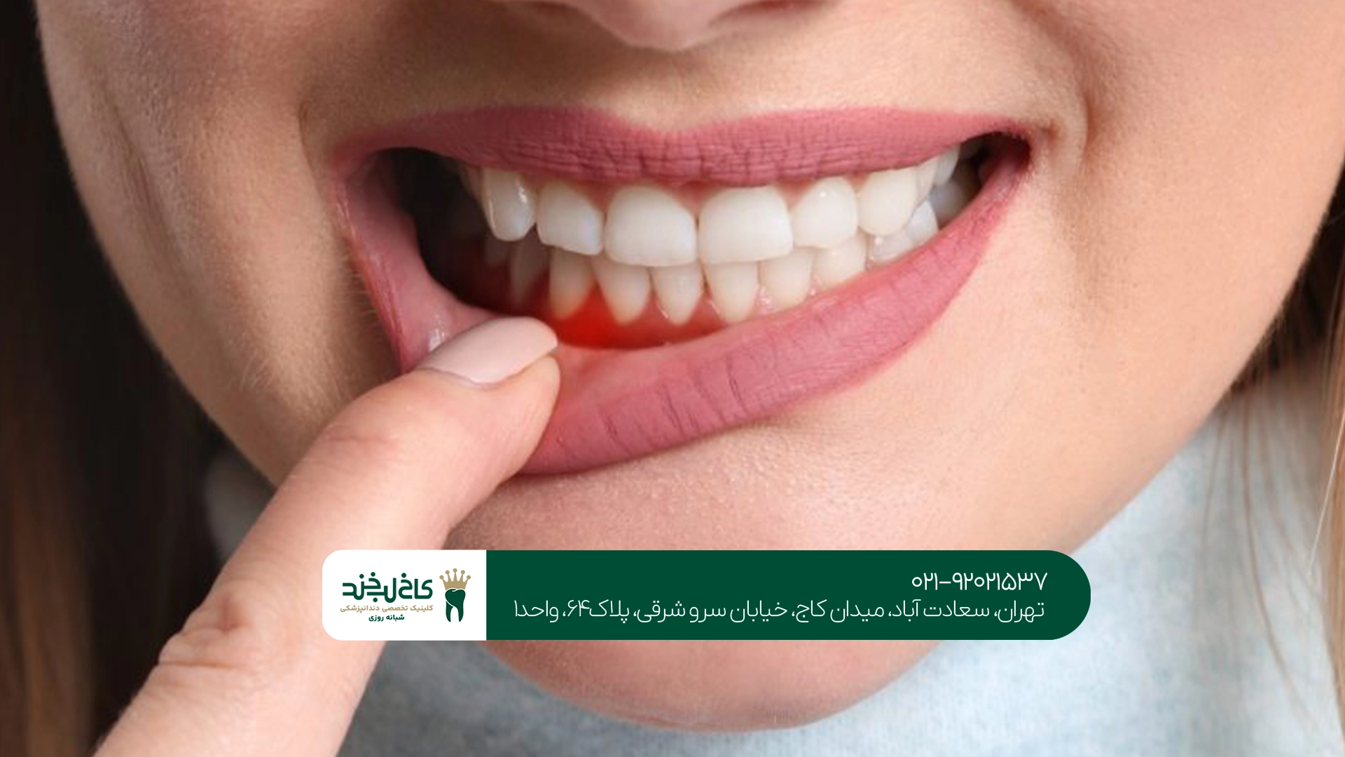 بهترین دندانپزشک برای درمان درد لثه
