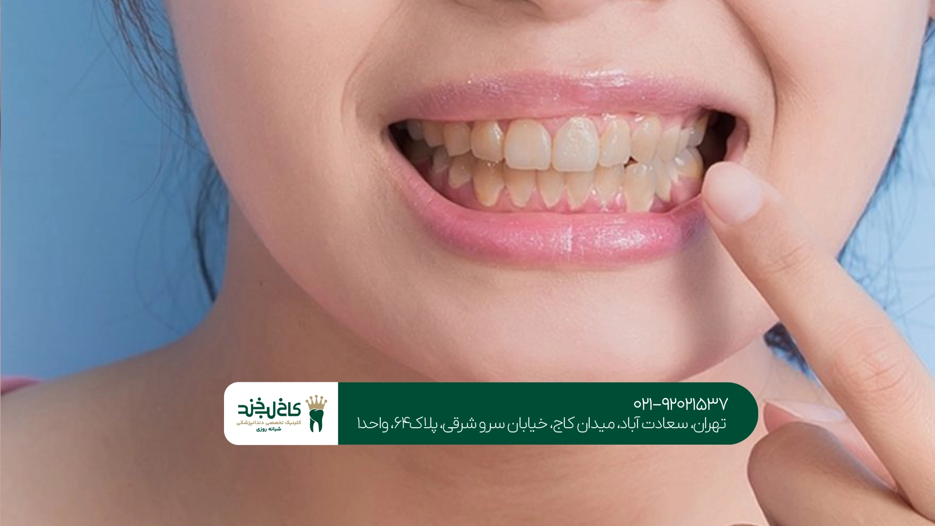 مهمترین عوامل زرد شدن دندانها