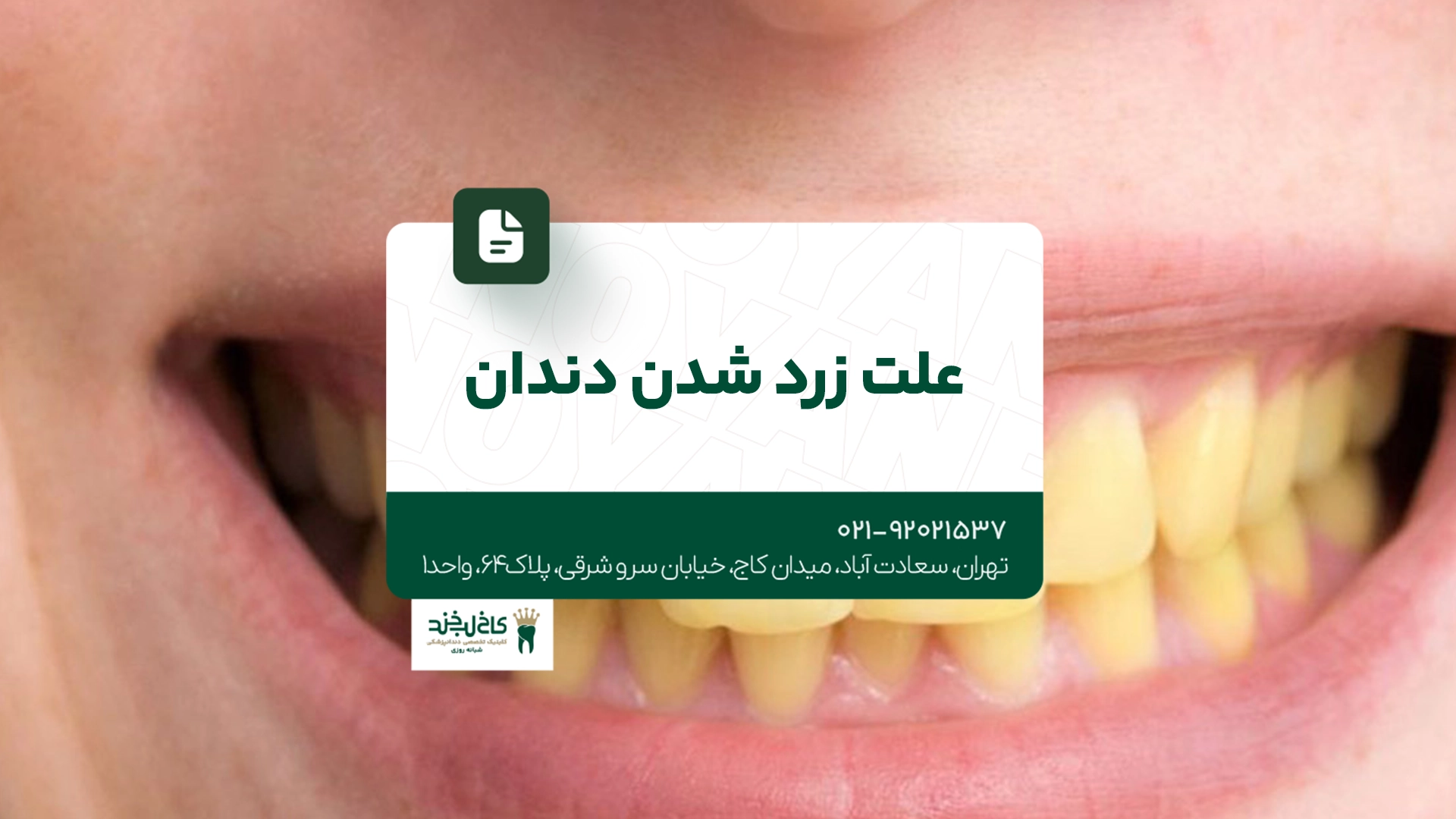 علت زرد شدن دندان