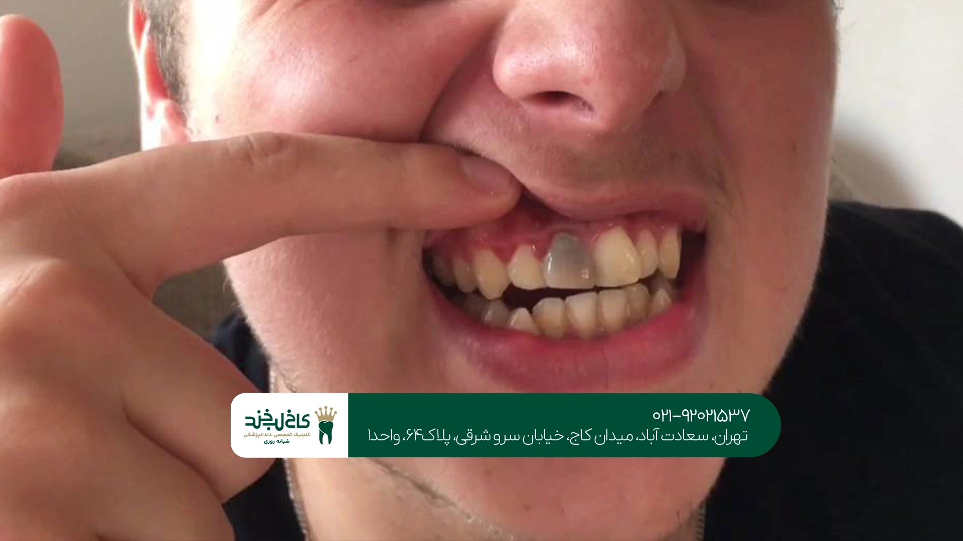 کلینیک درمان دندان سیاه