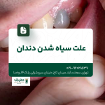 علت سیاه شدن دندان