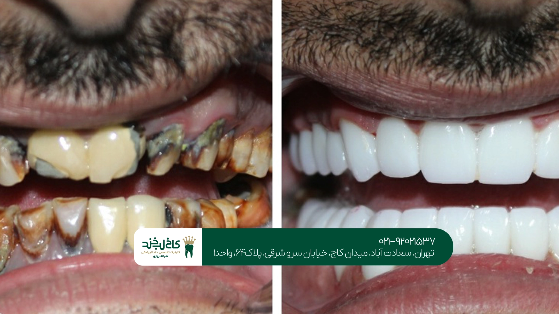 متخصص ترمیم دندان تهران