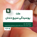علت پوسیدگی سریع دندان