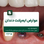 عوارض ایمپلنت دندان