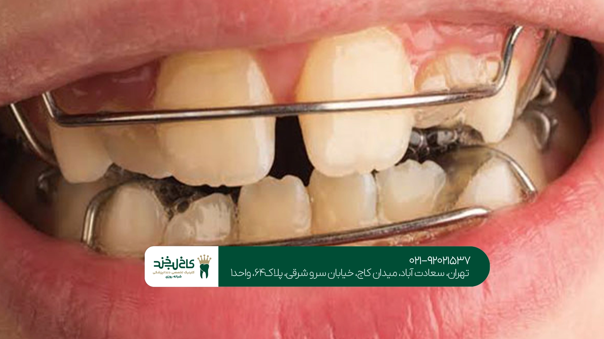 کلینیک دندانپزشکی کودکان