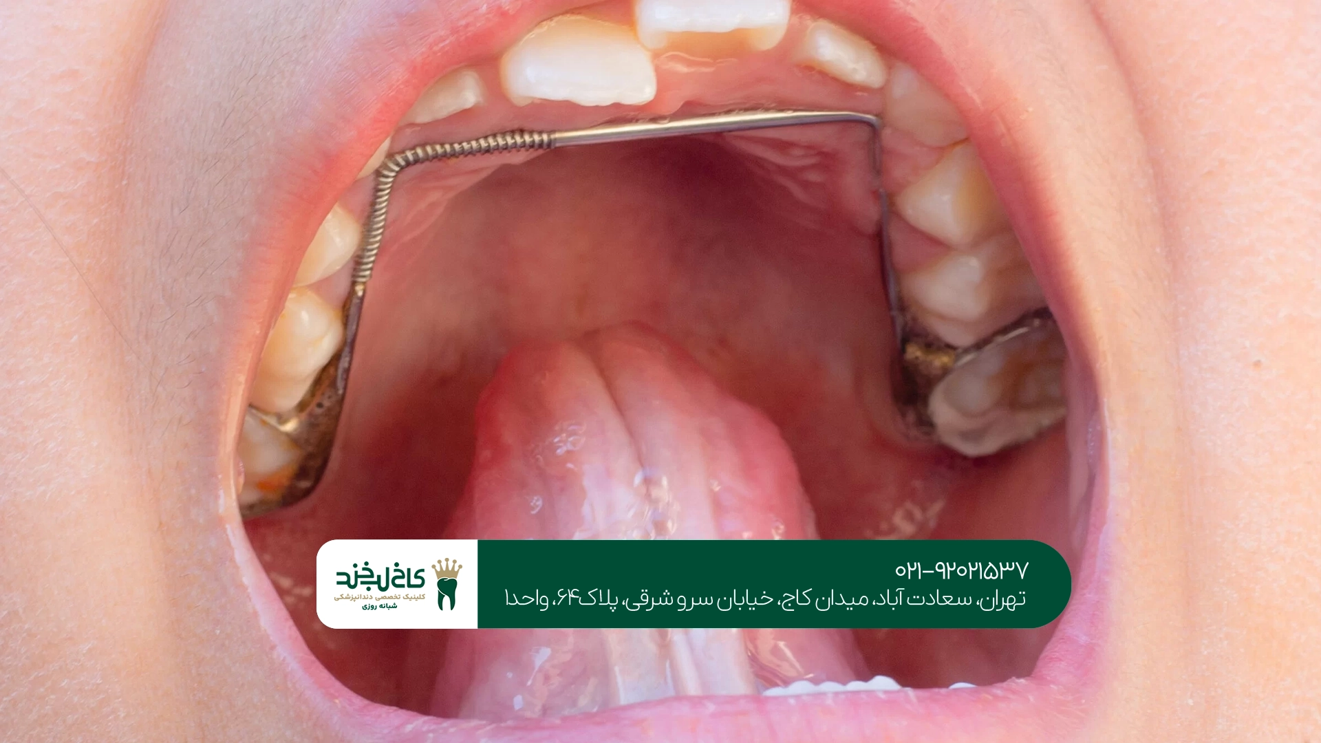 متخصص دندانپزشکی کودکان تهران