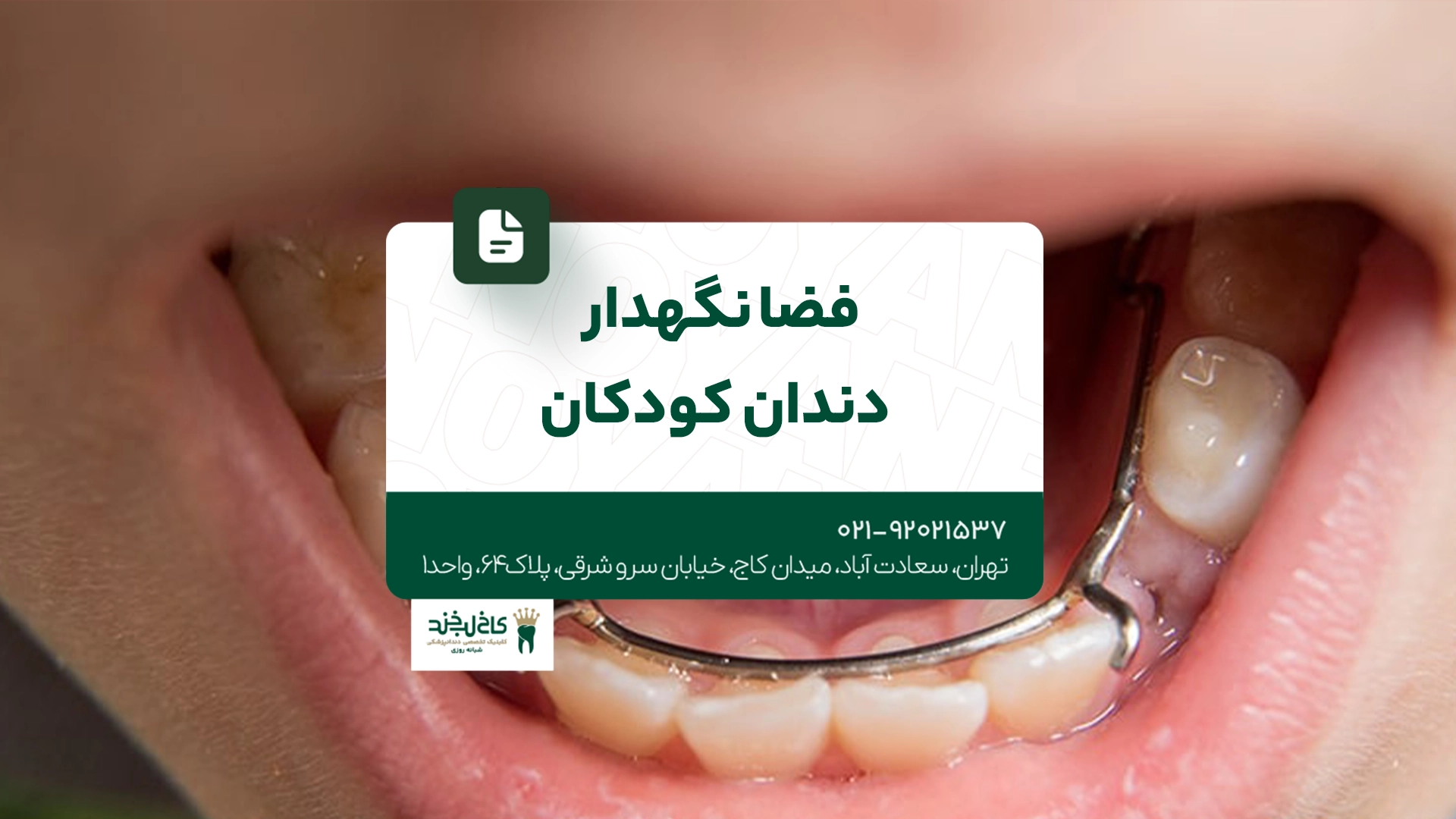 فضا نگهدار دندان کودکان