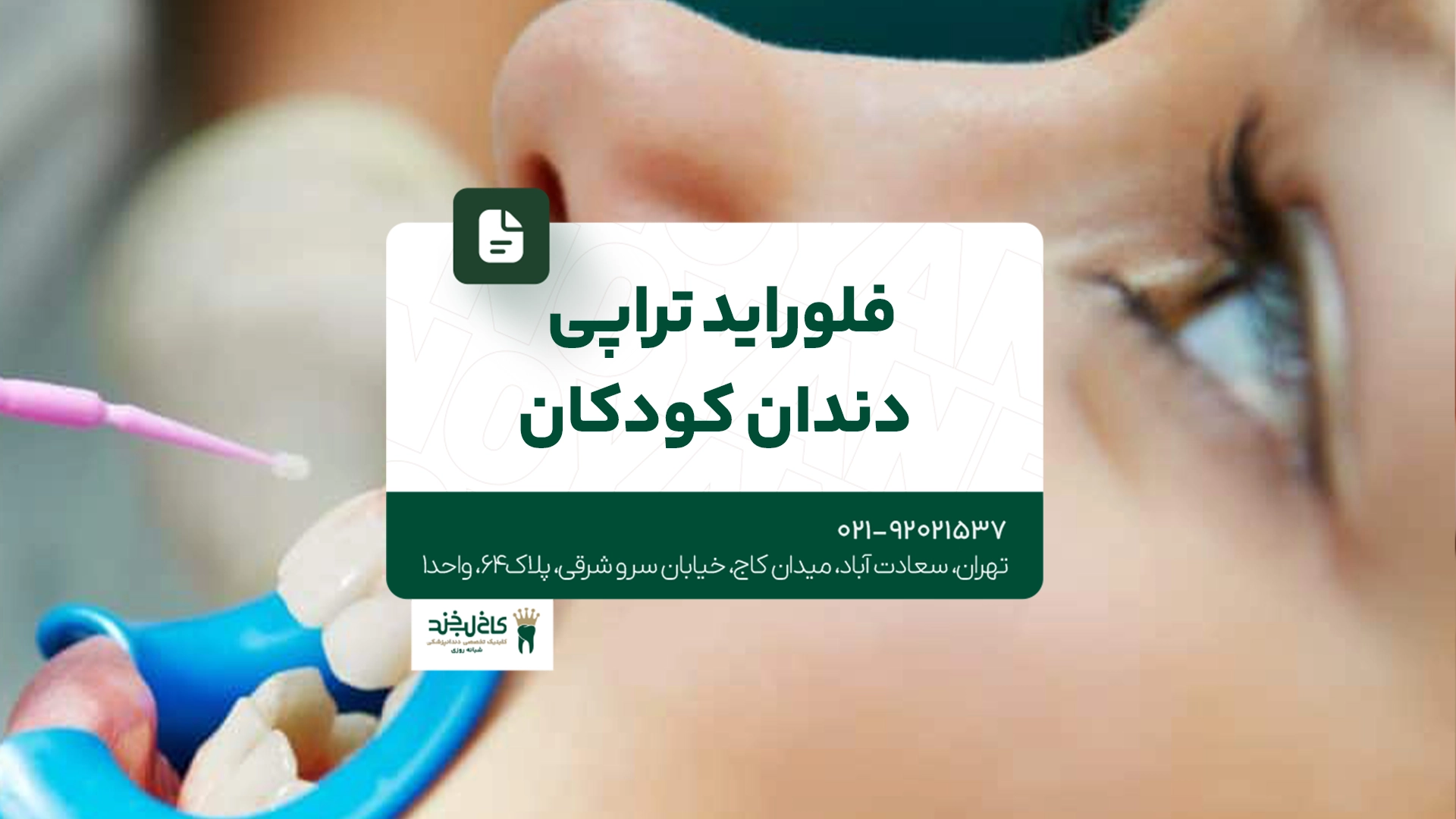 فلورایدتراپی دندان کودکان فلورایدتراپی دندان کودکان