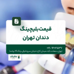 قیمت بلیچینگ دندان تهران