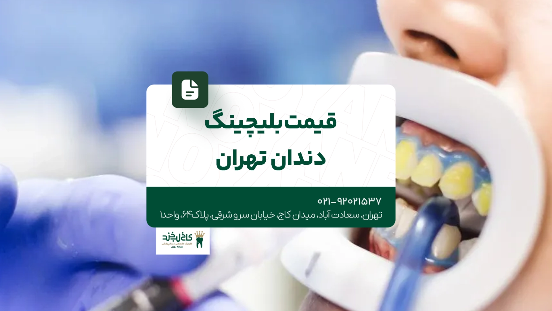 قیمت بلیچینگ دندان تهران