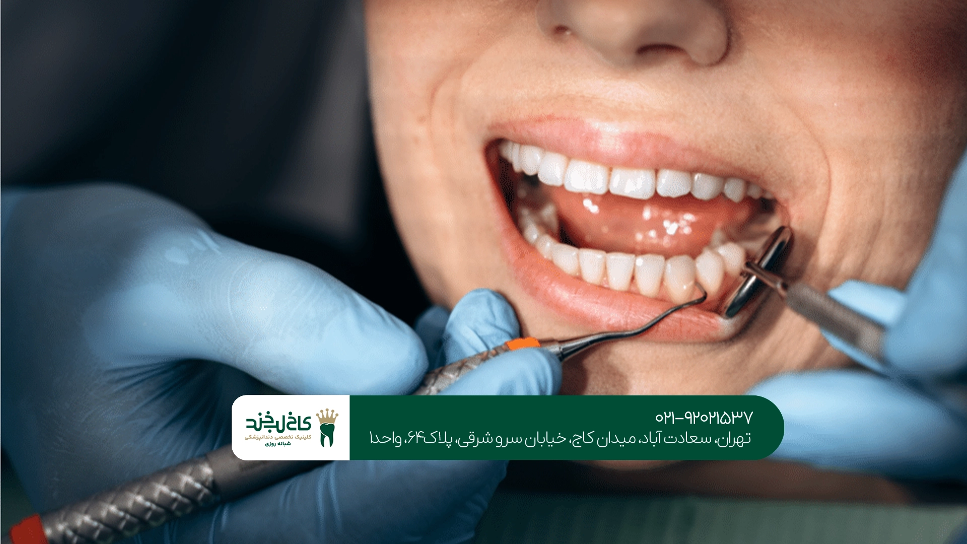 بهترین مرکز جرم گیری دندان