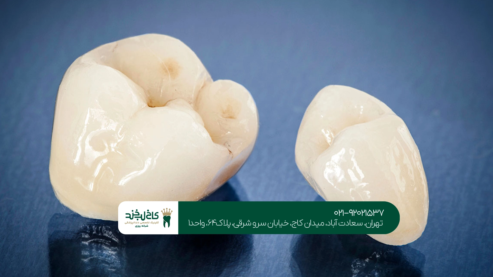 قیمت روکش برای دندان