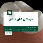 قیمت روکش دندان