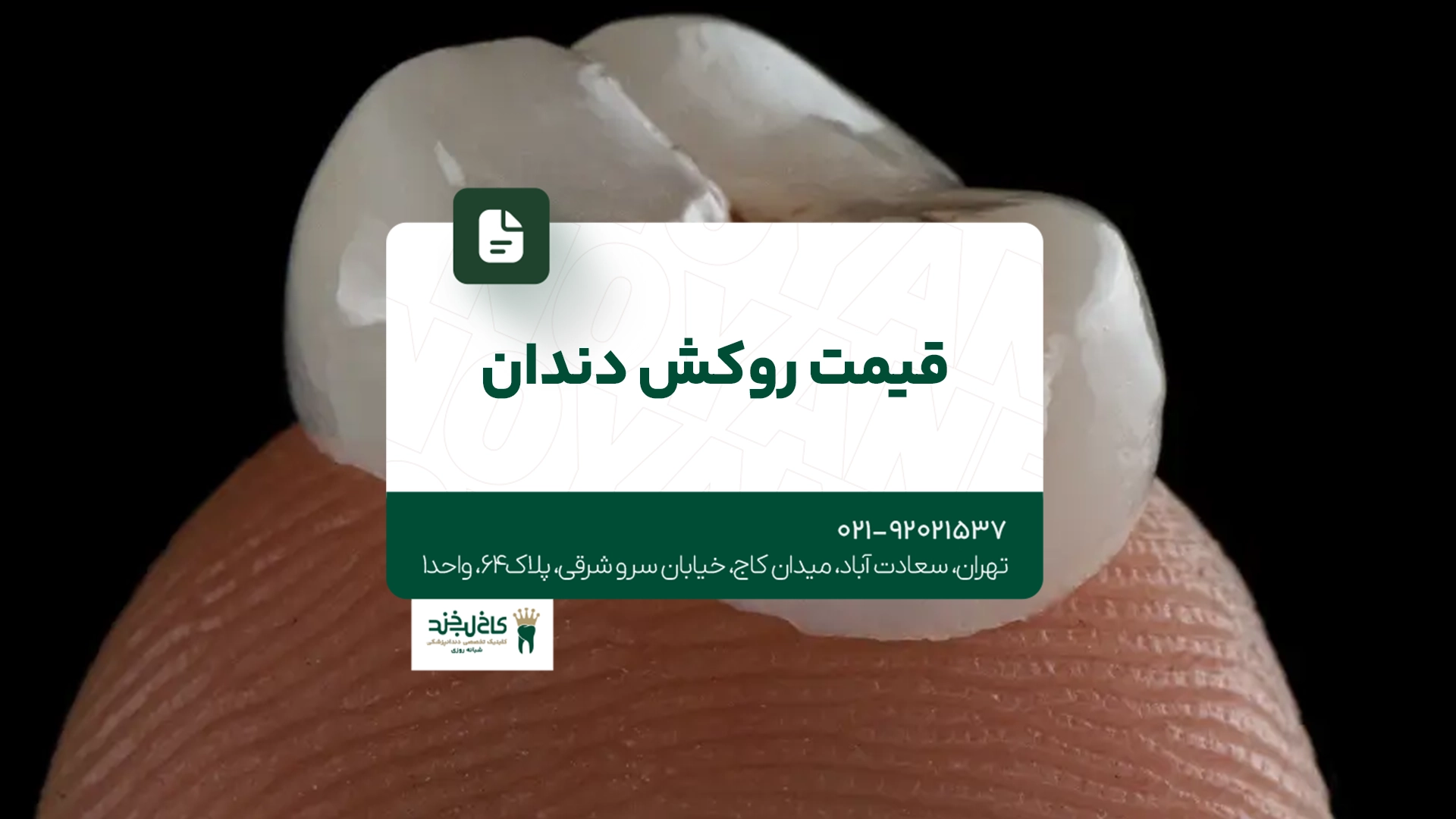 قیمت روکش دندان