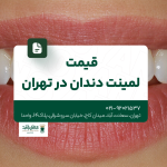 قیمت لمینت دندان در تهران