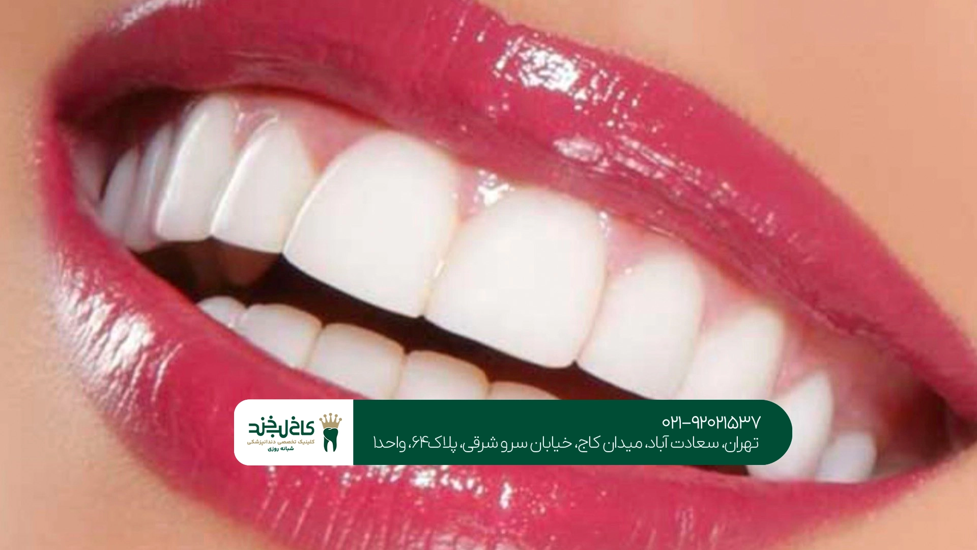 متخصص طراحی لبخند هالیوودی