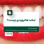 لبخند هالیوودی چیست