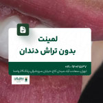 لمینت بدون تراش دندان