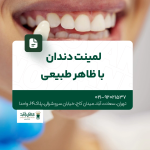 لمینت دندان با ظاهر طبیعی