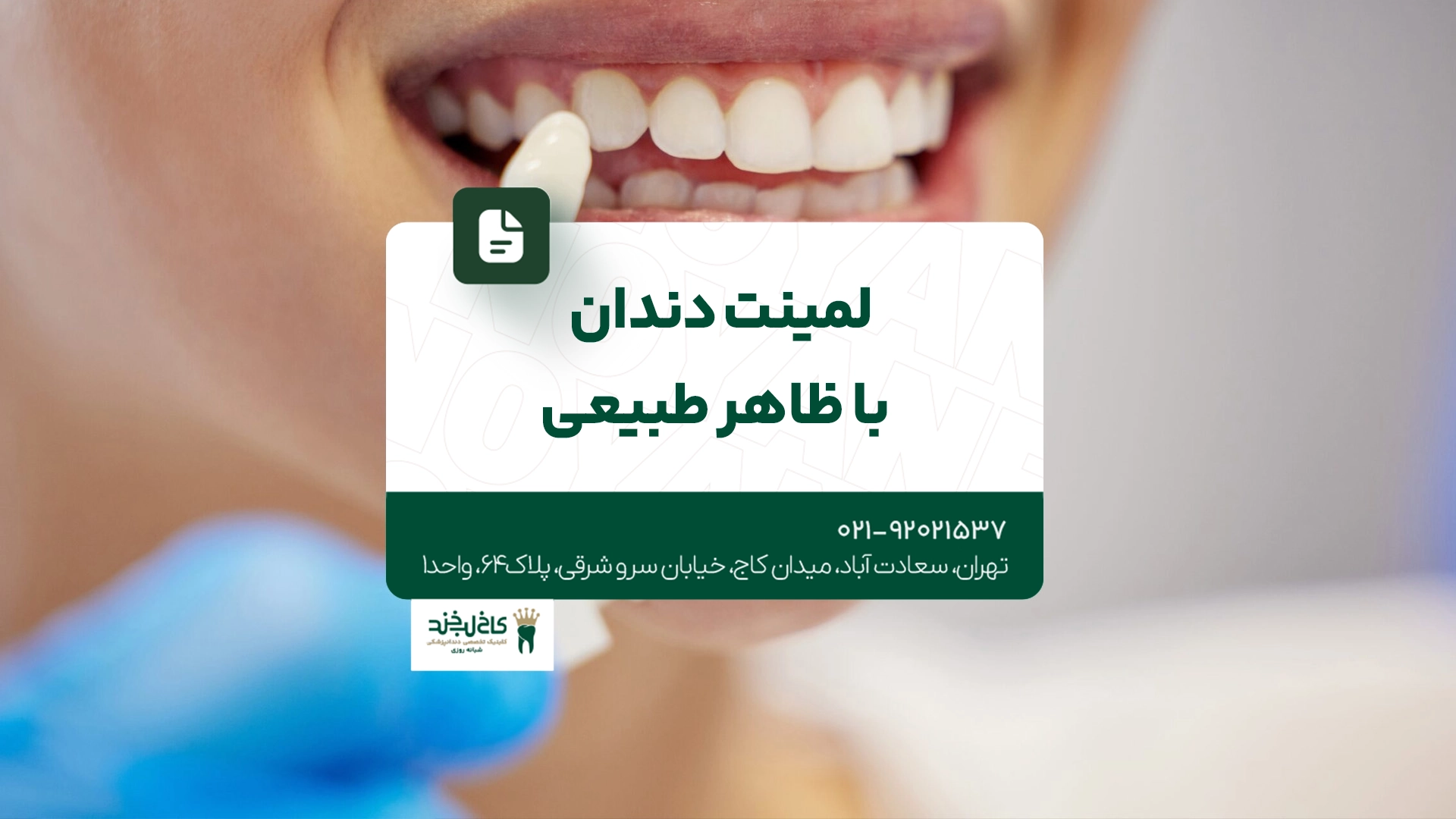 لمینت دندان با ظاهر طبیعی