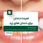لمینت دندان برای دندانهای زرد