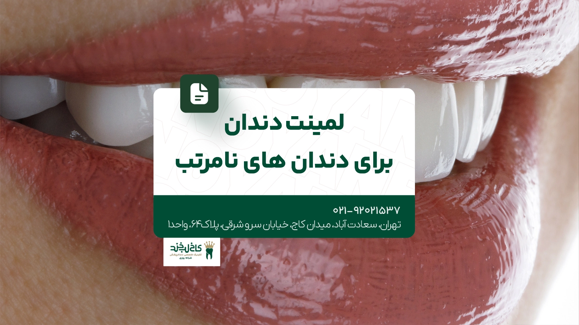لمینت دندان برای دندانهای نامرتب